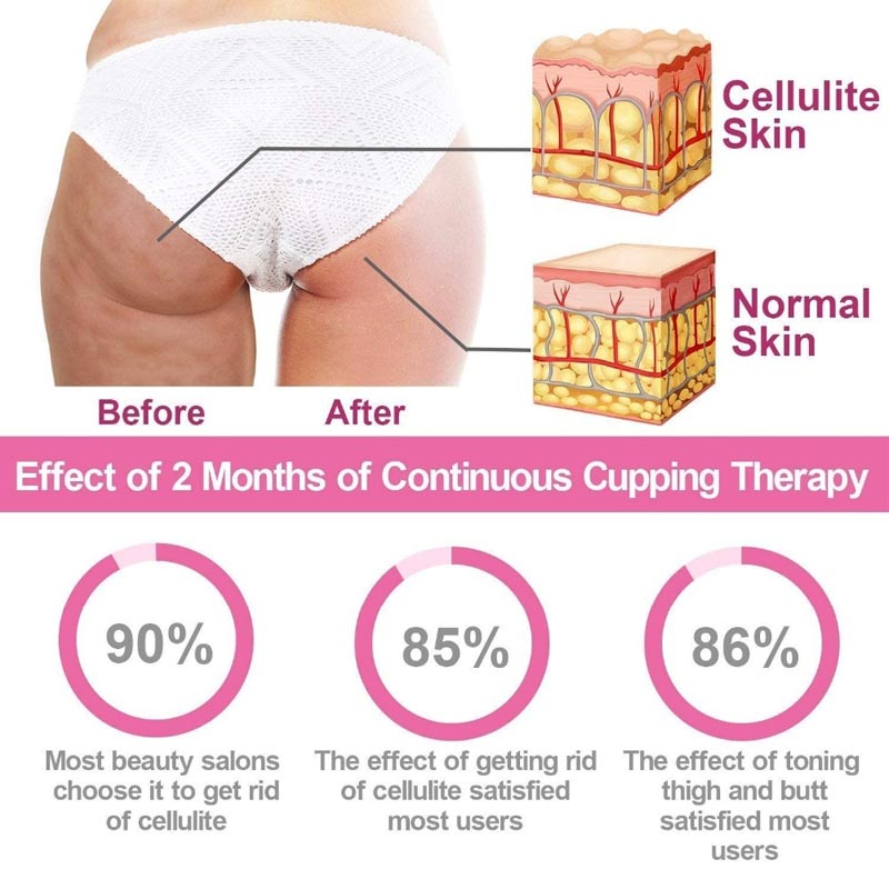 Beauty Massager D Type Fast Anti Cellulite Roller Handheld Anti Cellulite Leg Abdomen Neck Buttocks Massager Face Lift Tools Roller Health Care Cellulite Massage