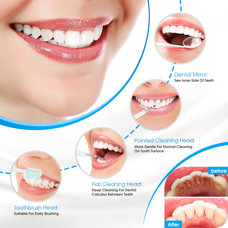 Electric Dental Calculus Remover Dental Cleaning Device Teeth Cleaner 5 gears IPX7 Waterproof Tooth Whitening Irrigator Remove Tartar Scaler Teeth Care