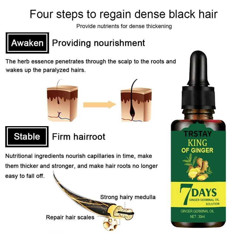 30ml Ginger Hair Care Essential Oil 7 Day Improves Scalp Environment Hair Loss Treatment Hair Growth Care Essence Oil Hair & Scalp Care