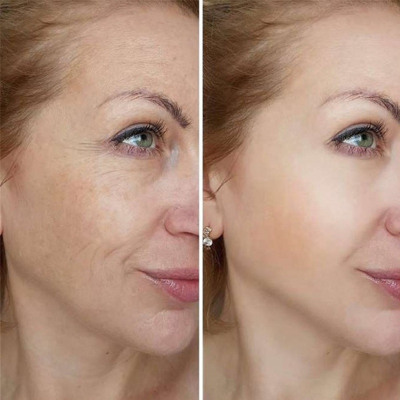 Private Parts Anti Wrinkle Essence Whitening Cream Chest Neck Face Armpit Firming Anti Aging Moisturizing Brightening Serum