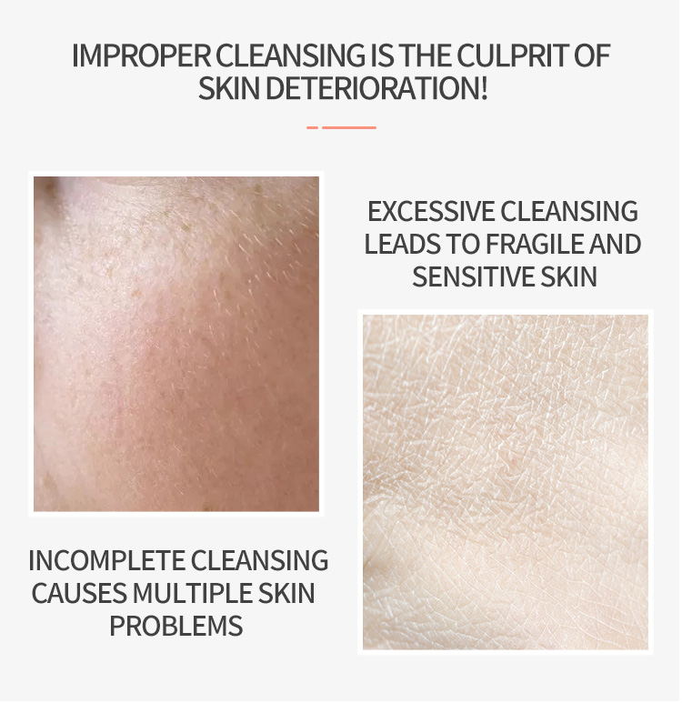 Arbutin Whitening Cleanser Amino Acid Foam Face Cleanser Fade Dark Spots Even Skin Tone Moisturizing Improve Dullness Skin Care