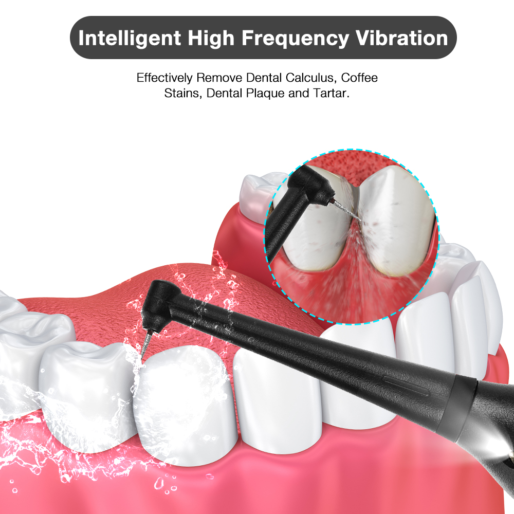 Electric Tooth Calculus Remover Sonic Dental Scaler Oral Irrigator Household Teeth Stains Tartar Tool Teeth Whitening Cleaner