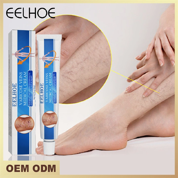 Varicose Vein Treatment Cream Repair Vasculitis Phlebitis Massage to Clear the Veins Relieve Leg Swelling Foot Care Body Care