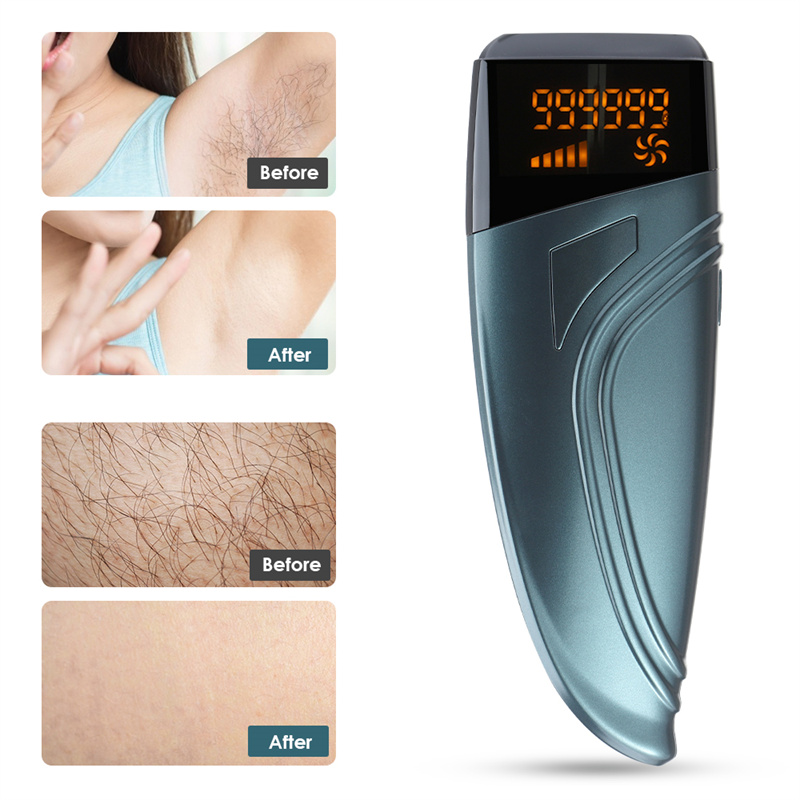 Women Laser Epilator Electric Hair Remover Machine IPL Photoepilator Painless Epilator Device