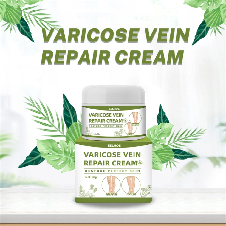 EELHOE Varicose Vein Repair Cream Tongmai Relieves Leg Varicose Vein Pain Relief Earthworm Leg Pain Red Blood Silk Spider Leg